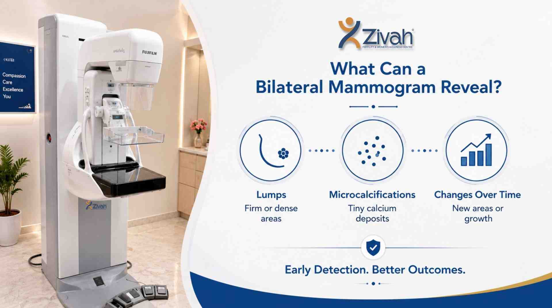 What Can a Bilateral Mammogram Reveal- Zivah fertility.jpg